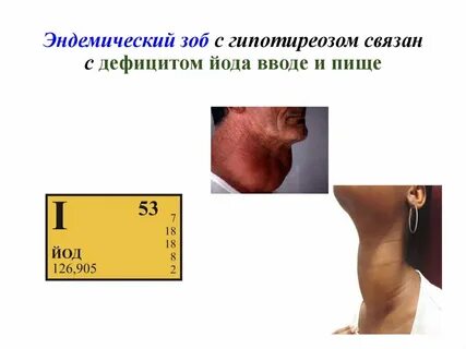 Дефицит карт