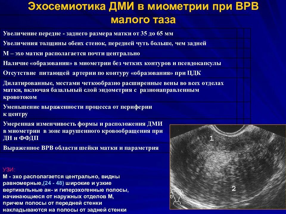 Полость матки 10. Структура миометрия однородная. Структура эндометрия на УЗИ. Локальное утолщение миометрия.