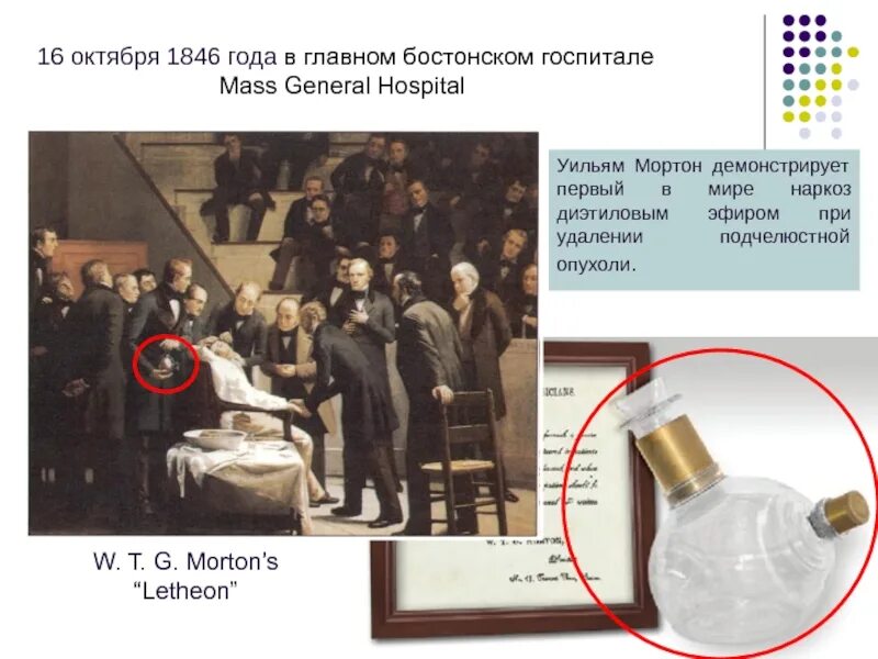 Наркоз отнимает. Мортон наркоз 1846. уильям мортон наркоз. первый наркоз эфиром. мортон анестезия.