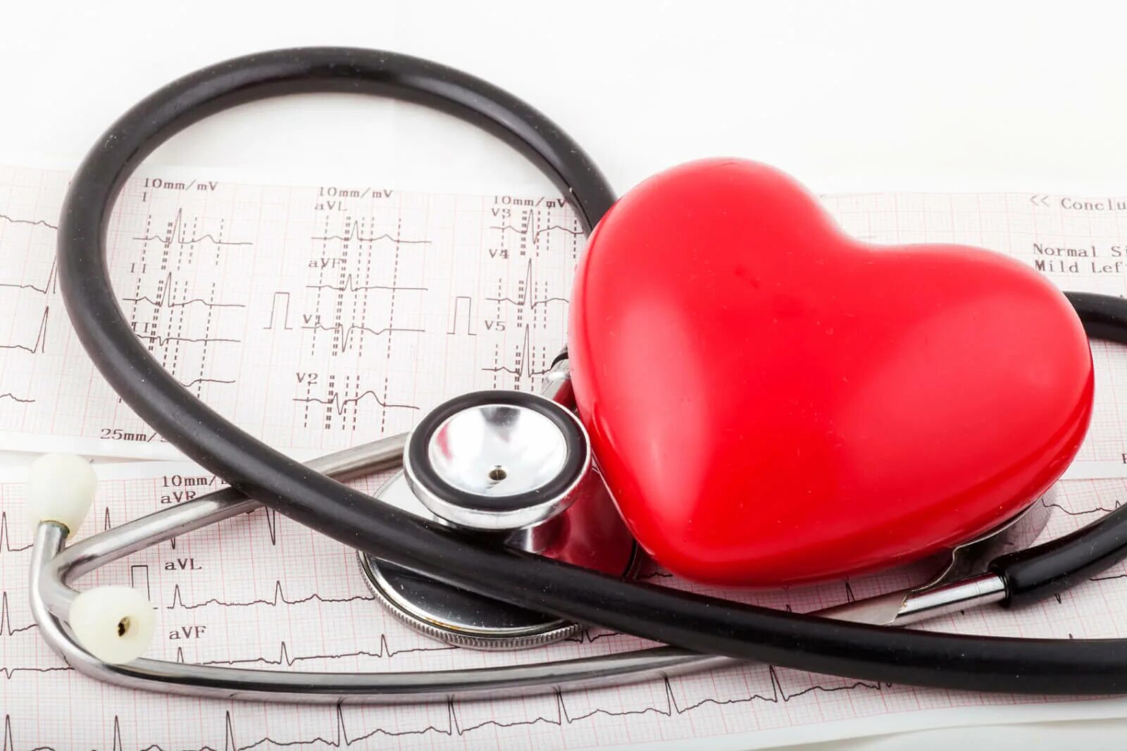Терапия сердечно сосудистых заболеваний. Сердечно-сосудистые заболевания. Электрокардиография кардиология.