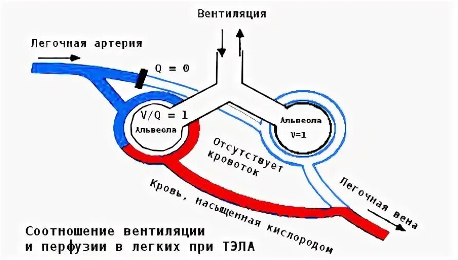 Соотношение вентиляции и перфузии. Перфузия и вентиляция. нарушение соотношения перфузии и вентиляции. перфузионно вентиляционное соотношение. вентиляционно перфузионные отношения.