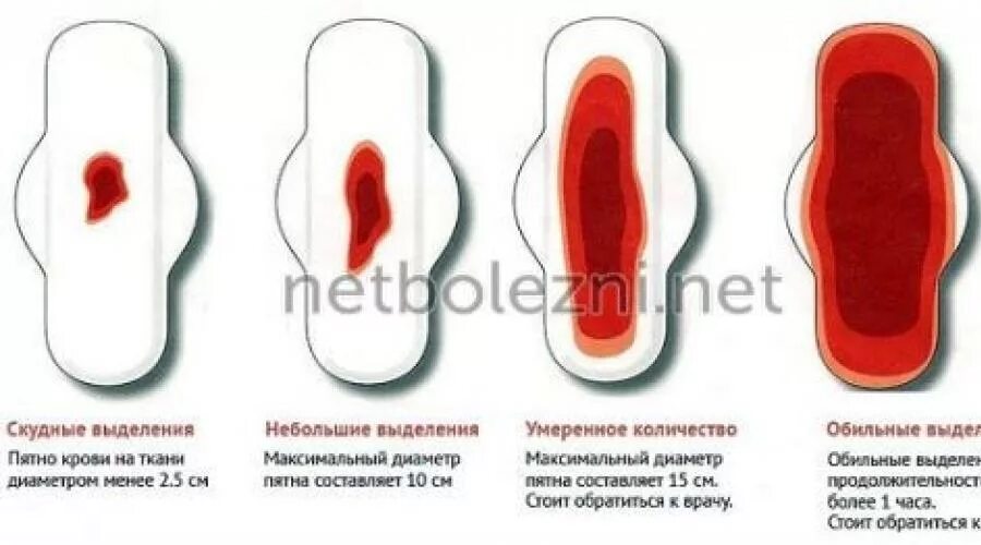 Кровь после акта при беременности. Цвет месячных в первый день. Нормальный цвет месячных по дням.