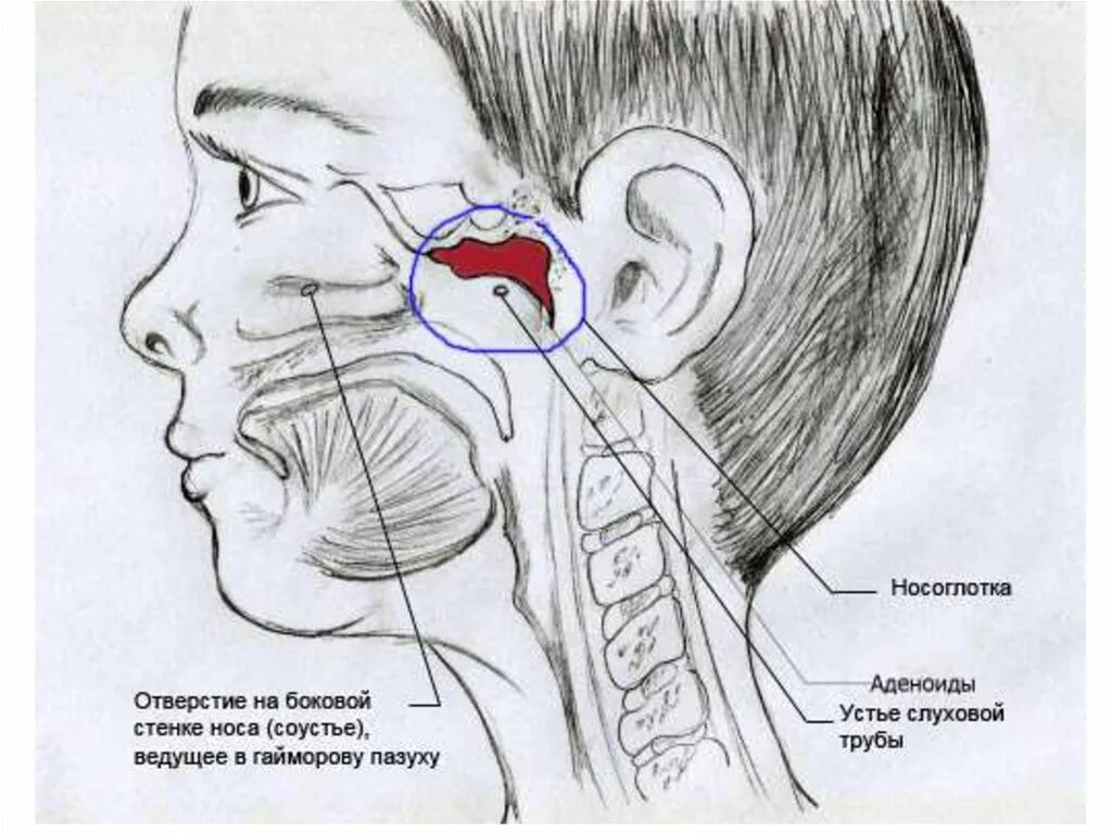 Болит горло уши и голова. Строение носоглотки и уха. Связь между ухом и носом.