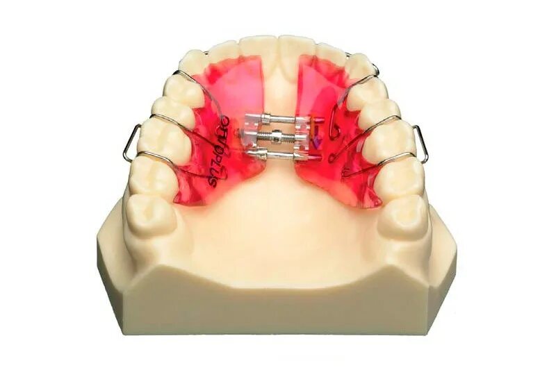 Аппарат Шварца ортодонтия. Аппарат Гербста ортодонтия. Съёмный пластиночный аппарат Шварца. Пластинка Шварца ортодонтия. Расширение челюсти цена