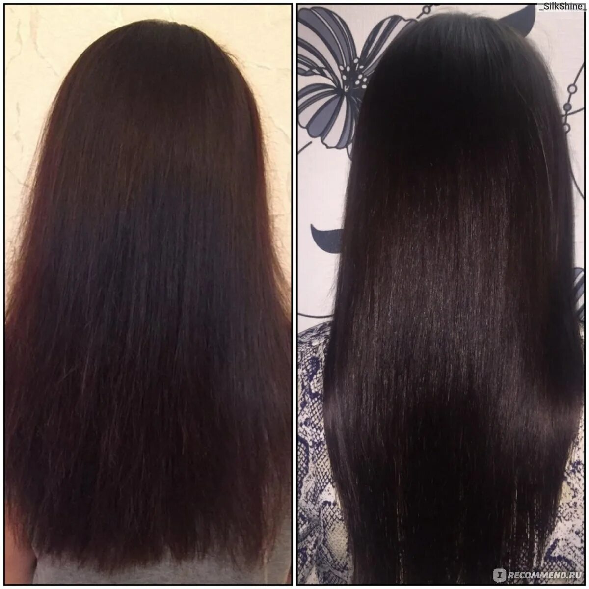 Волосы до и после дарсонваля. Дарсонвализация волос до и после. Дарсонваль для волос эффект до и после. Дарсонваль для волос до и после.