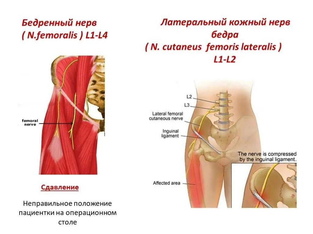 Нейропатия бедра. Подкожный нерв бедра анатомия. Латеральный бедренный кожный нерв. Болит латеральный нерв бедра. Защемление ножного нерва.
