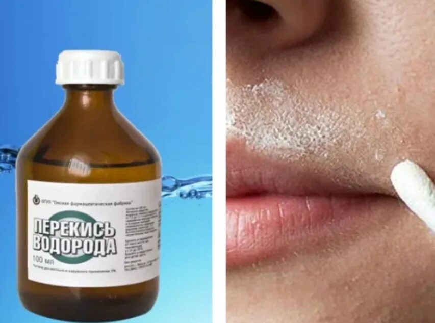Можно ли избавиться от белых