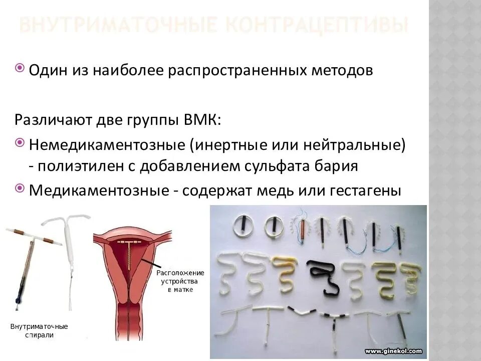 Введение вмс. Инертная внутриматочная спираль. Медьсодержащая внутриматочная спираль. Формы внутриматочных спиралей. Методы контрацепции спираль.