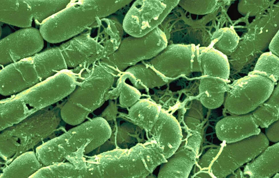 Bacillus thuringiensis var thuringiensis. Bacillus thuringiensis колонии. картофель bacillus thuringiensis. bacillus thuringiensis под микроскопом.