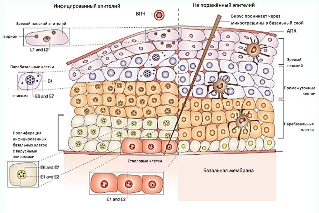 Клетки зоны трансформации. Squamous epithelial Cells locations. Папилломавирус в мазке.