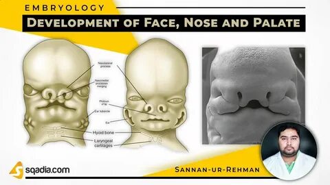 Face development