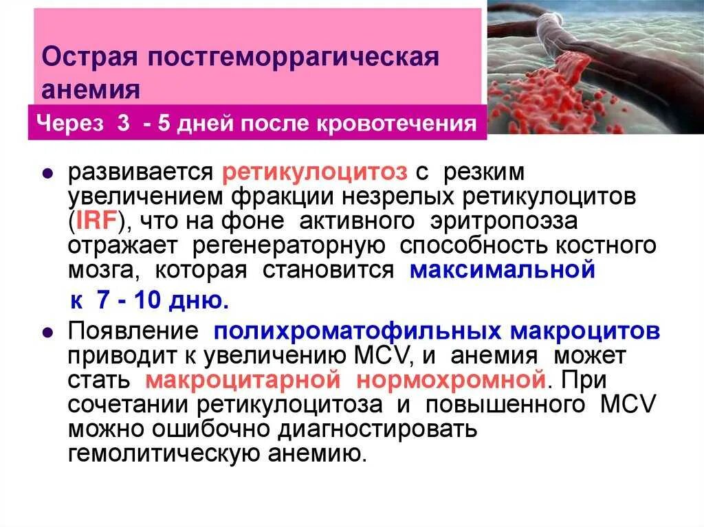 Причины анемии крови. Осложнения постгеморрагической анемии. Осложнения острой постгеморрагической анемии. Хроническая постгеморрагическая анемия цветовой показатель. Клинические проявления острой постгеморрагической анемии.