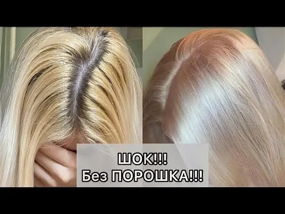 Teen who tried to go blonde at home horrified after bleach melted her hair and i