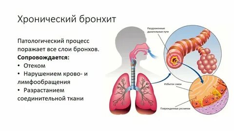 Болезни органов дыхания бронхит