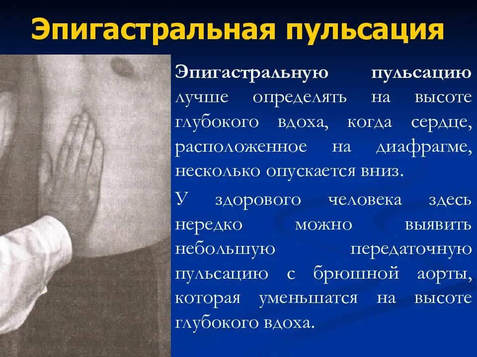 Что справа внизу живота у мужчин. Причины эпигистрального пульсации. Причины эпигистрального пульсации. Боли слева под ребрами сбоку спереди у женщин. Карта боли в животе.