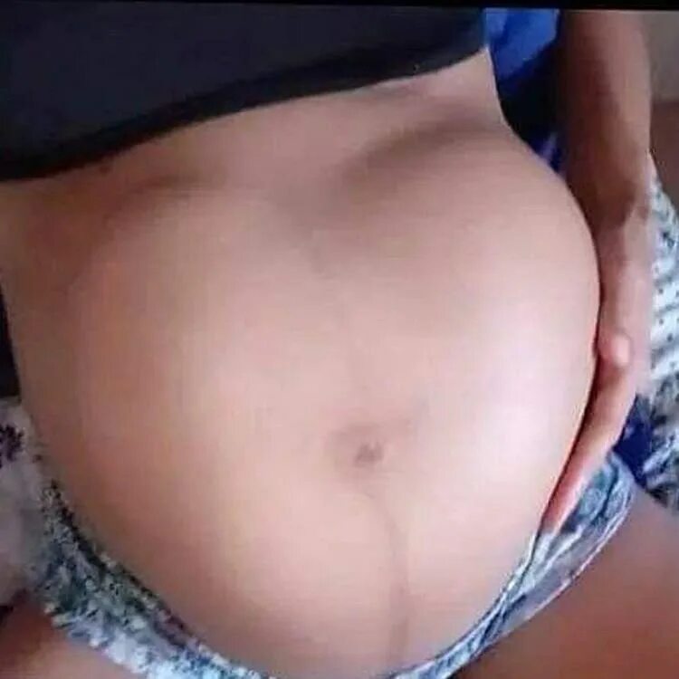 бабушка беременная близнецами. беременная женщина. приснилась беременность многоплодная. сонник беременная. многоплодная беременность.