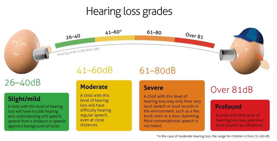 Hearing перевод. Hearing loss grades. international classification of hearing loss. hearing level (db hl). hearing loss degree.