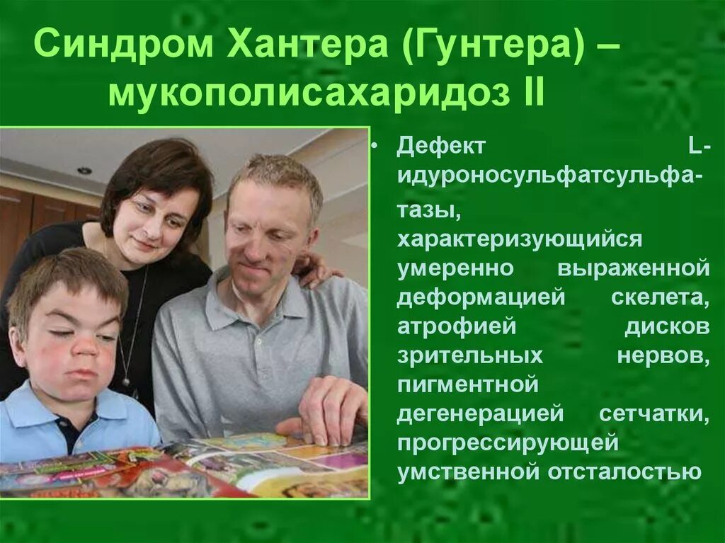 Хантер ребенок. Синдром Хантера мукополисахаридоз. Мукополисахаридоз II типа (синдром Хантера). Синдром Хантера (Гунтера).