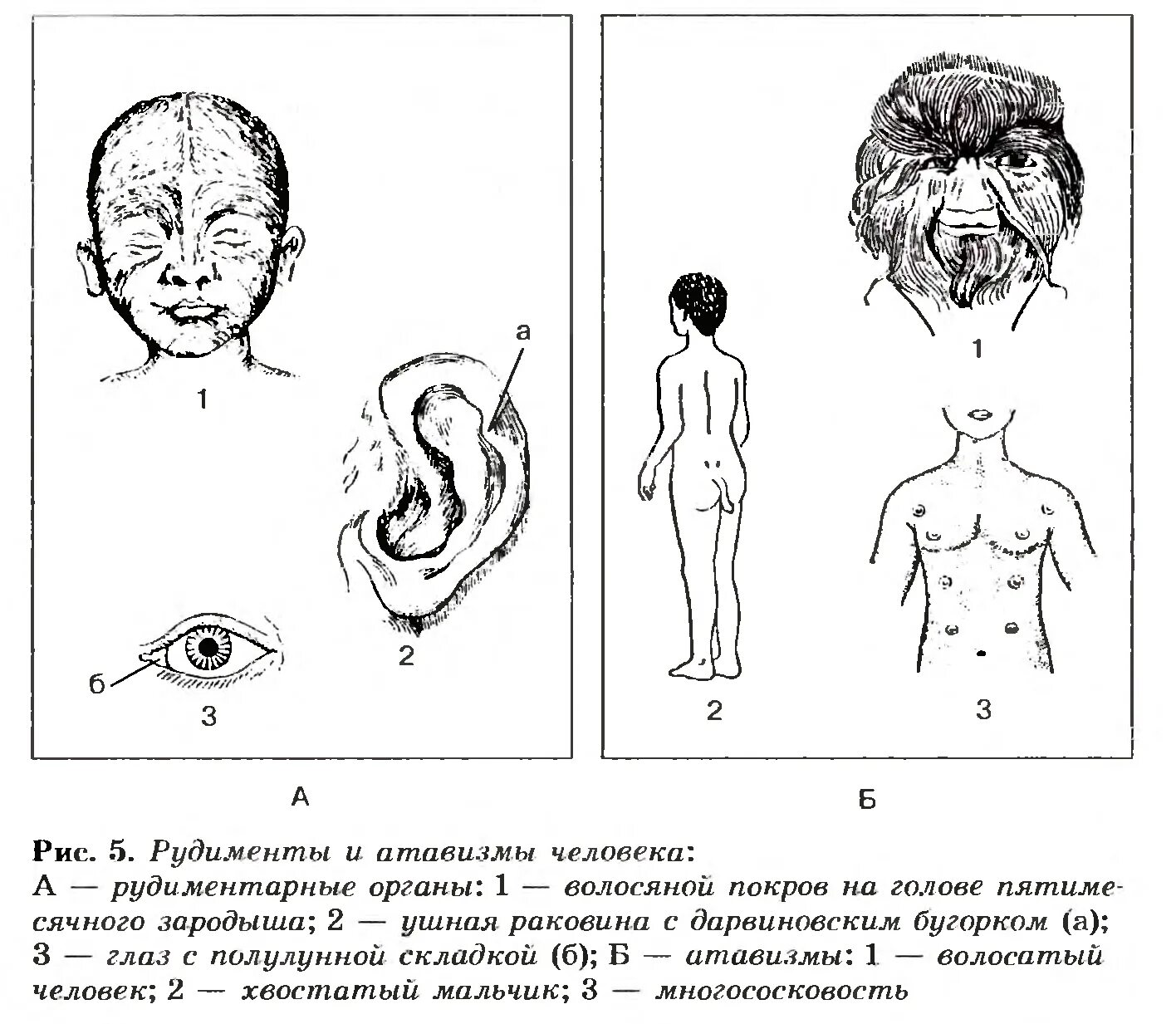 Атавизмы человека аппендикс. Атавизмы и рудименты человека. Рудименты человека атавизмы человека. Атавизм многососковость. Атавизмы и рудименты схема.