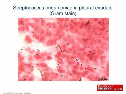 S pneumoniae
