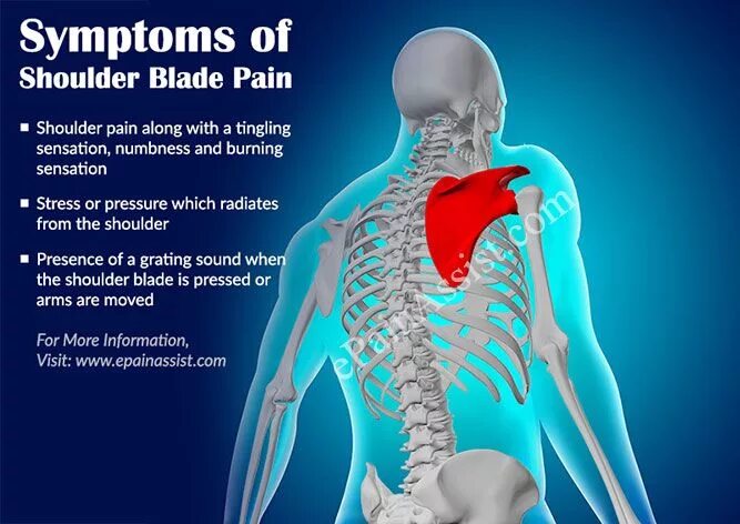 Shoulder Blade. Pain in Shoulder. Shoulder Blade картинки. Shoulder Blades Movement. Back between