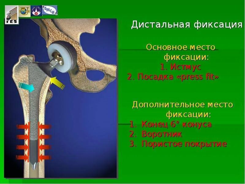 Способы фиксации. Фиксированные места. Сканер фиксации опасностей. Фиксированные места. Фиксированные места.