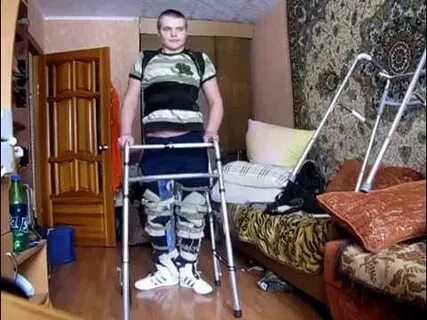 Реабилитация ребенка после перелома ноги
