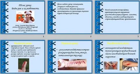 Виды рани