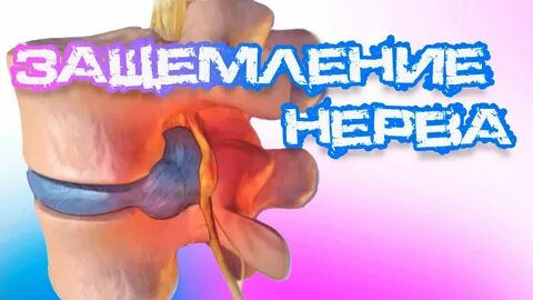 Защемление нерва: уникальные методы лечения от доктора Белозёровой! - смотреть в