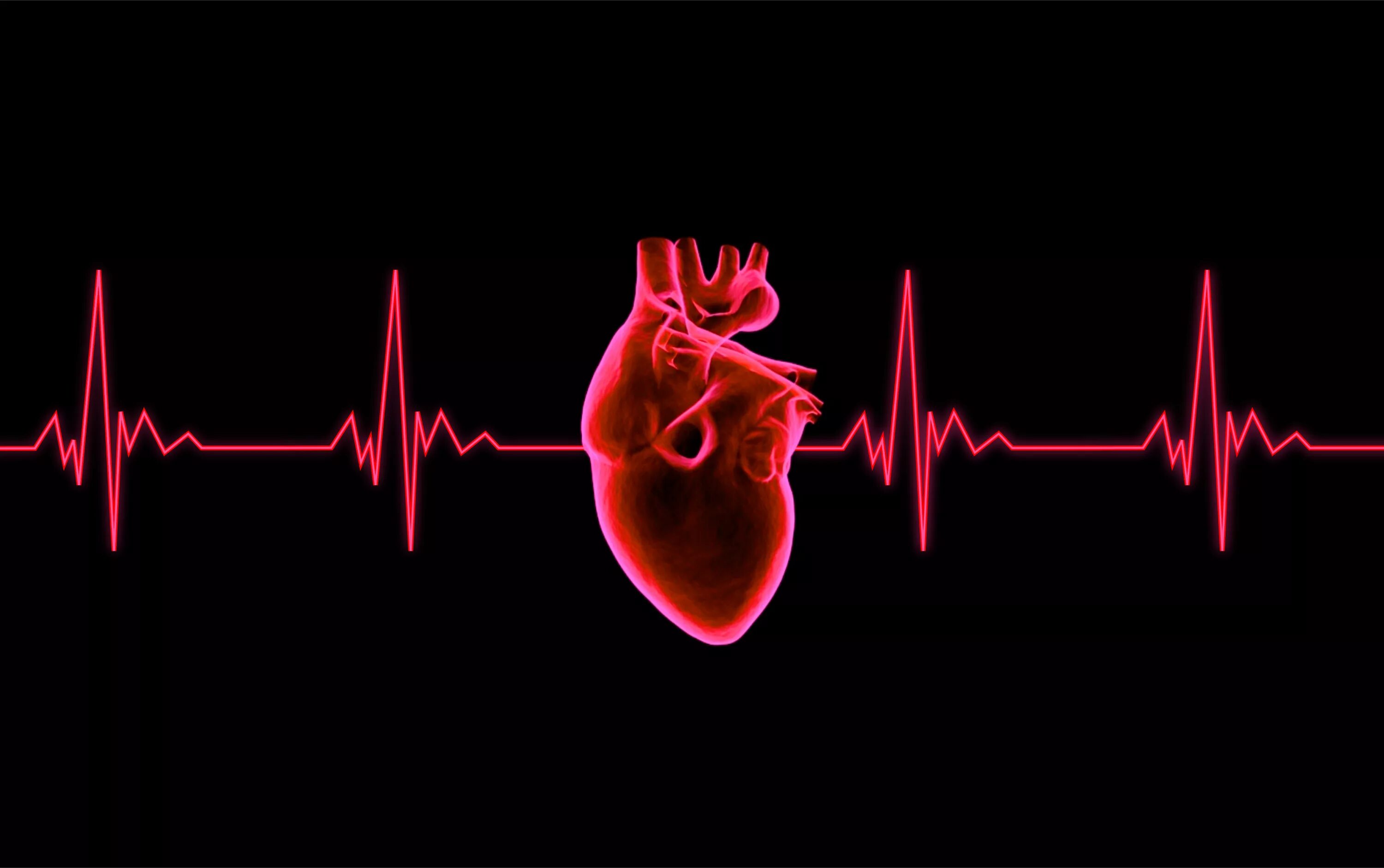 Легкое сердцебиение. Аритмогенная кардиомиопатия на ЭКГ. Кардиограмма сердца. ЭКГ сердца. "Ритм" (сердечный).