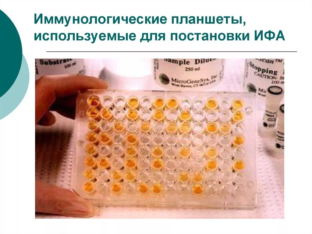 Сыворотка ифа. Elisa иммуноферментный анализ. метод иммуноферментного анализа (ифа).. результат ифа микробиология. твердофазный иммуноферментный анализ.