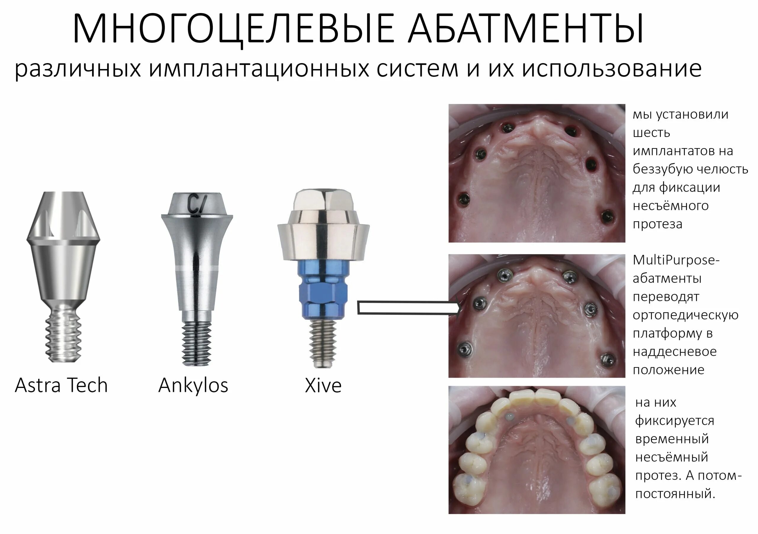 Через сколько можно вставлять зубы. Имплант абатмент коронка. Имплант формирователь коронка. Этапы имплантации зуба абатмент. Имплант формирователь десны абатмент коронка.