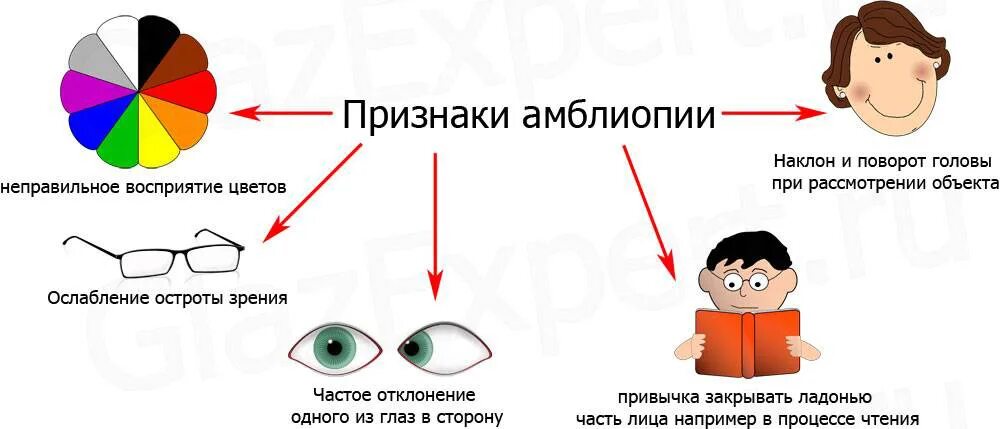 Признаки цветной. Амблиопия схема глаза. Рефракционная амблиопия степени. Амблиопия симптомы. Ленивый глаз симптомы.