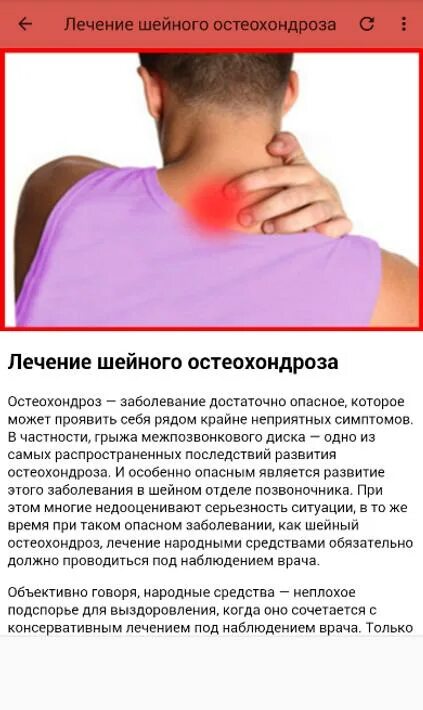 Остеохондроз шейного отдела как снять боль. Шейный остеохондроз. что болит при шейном остеохондрозе. шейный остеохондроз симптомы. при остеохондрозе шейного отдела.