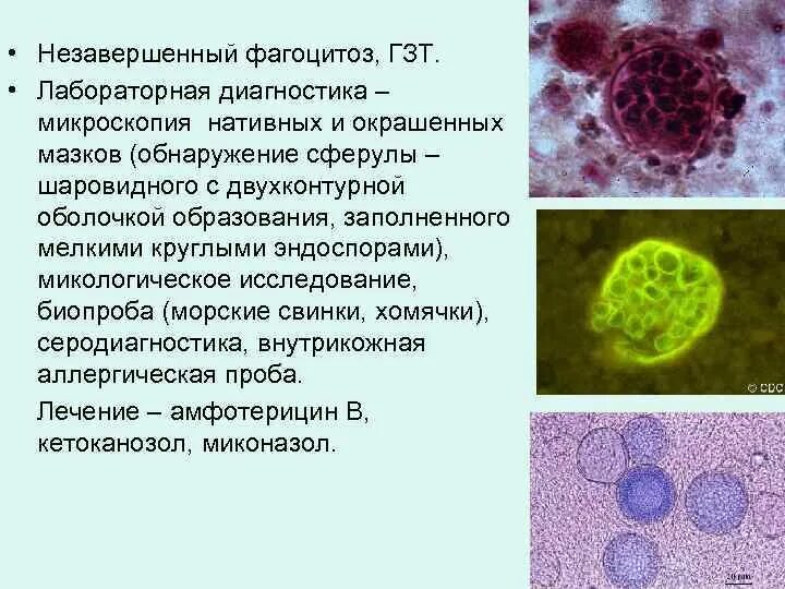 Фагоцитоз в мазке у женщин