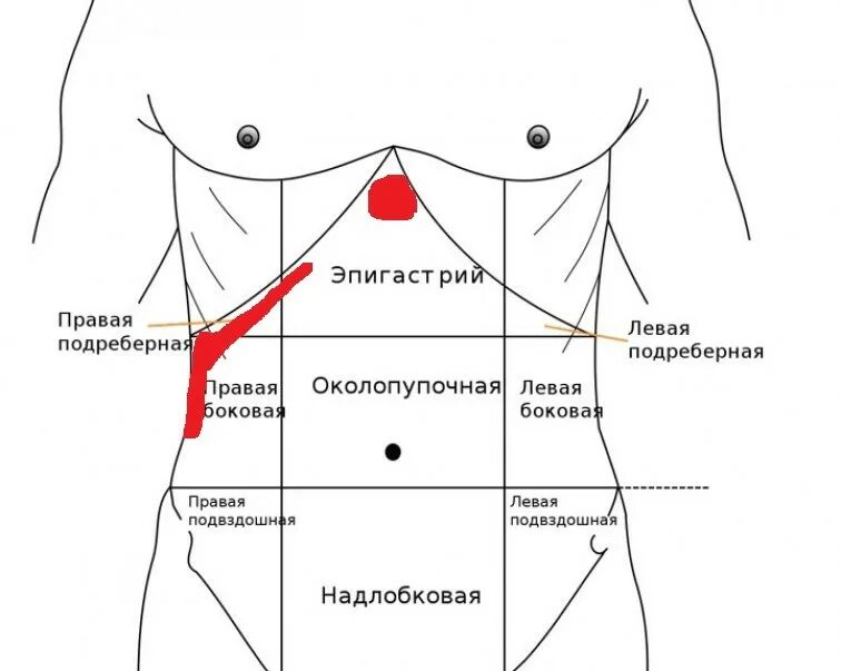 Боль под ребрами слева спереди у мужчин. Боль в правом боку. Что болит в правом боку. Боль в правом боку под ребрами. Больв правом боку под ребками.