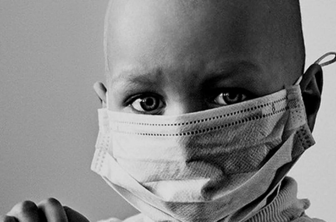 Дети с онкологическими заболеваниями. Ребенок в маске заболевания. Больные дети онкологии