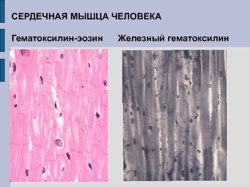 Поперечно полосатые мышцы и гладкие мышцы. Поперечно мышечная ткань гистология. Скелетная мышечная ткань гистология препарат. Гладкая мышечная ткань окраска гематоксилином и эозином. Сердечная мышечная ткань железный гематоксилин.