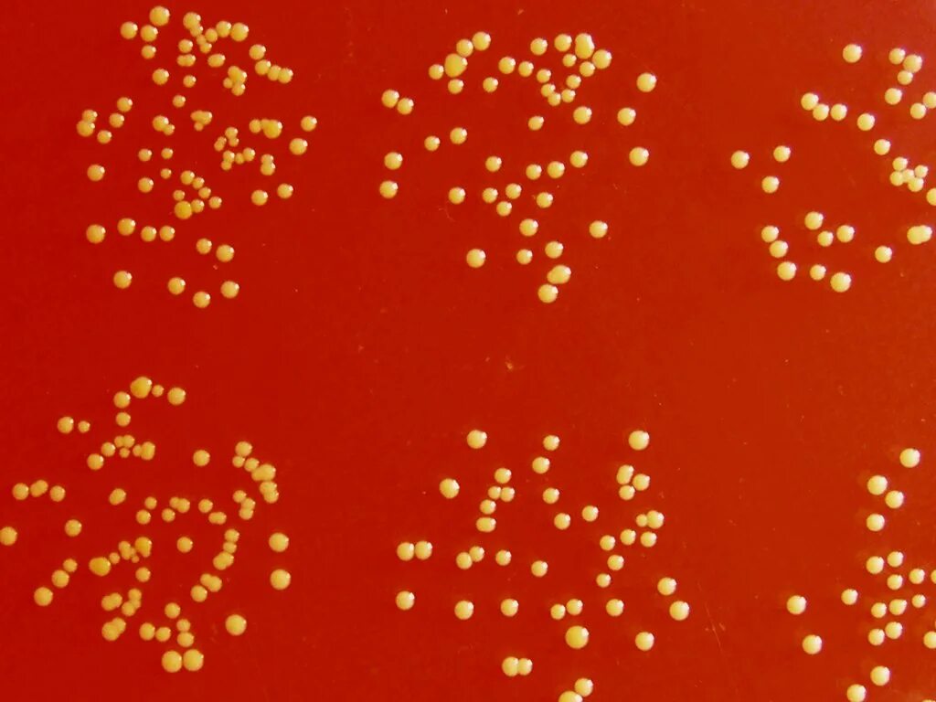 Staphylococcus chromogenes. Staphylococcus aureus капсула. Золотистый стафилококк на коже. Стафилококк Варнери.