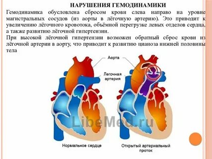 Тела гемодинамика