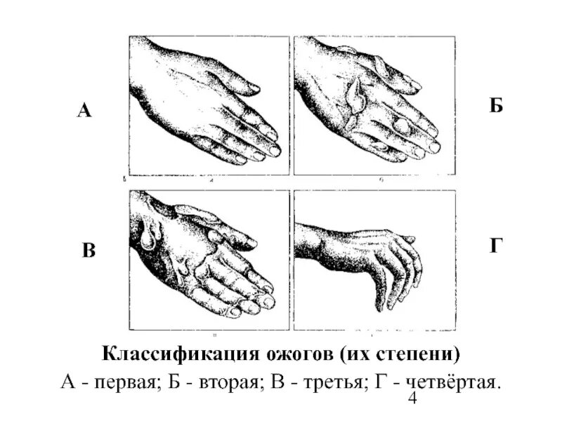 Клиническая признаки термического ожога. Постановление структура документа. Клинические проявления термических ожогов 2 степени. Термический ожог: 1 степень 2 степень 3 степень 4 степень первая помощь. Ожоги 1 степень 2 степень 3 степень 4 степень.