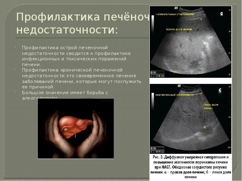 Профилактика печеночной недостаточности. Профилактика острой печеночной недостаточности. Профилактика хронической печеночной недостаточности. УЗИ печени при печеночной недостаточности.