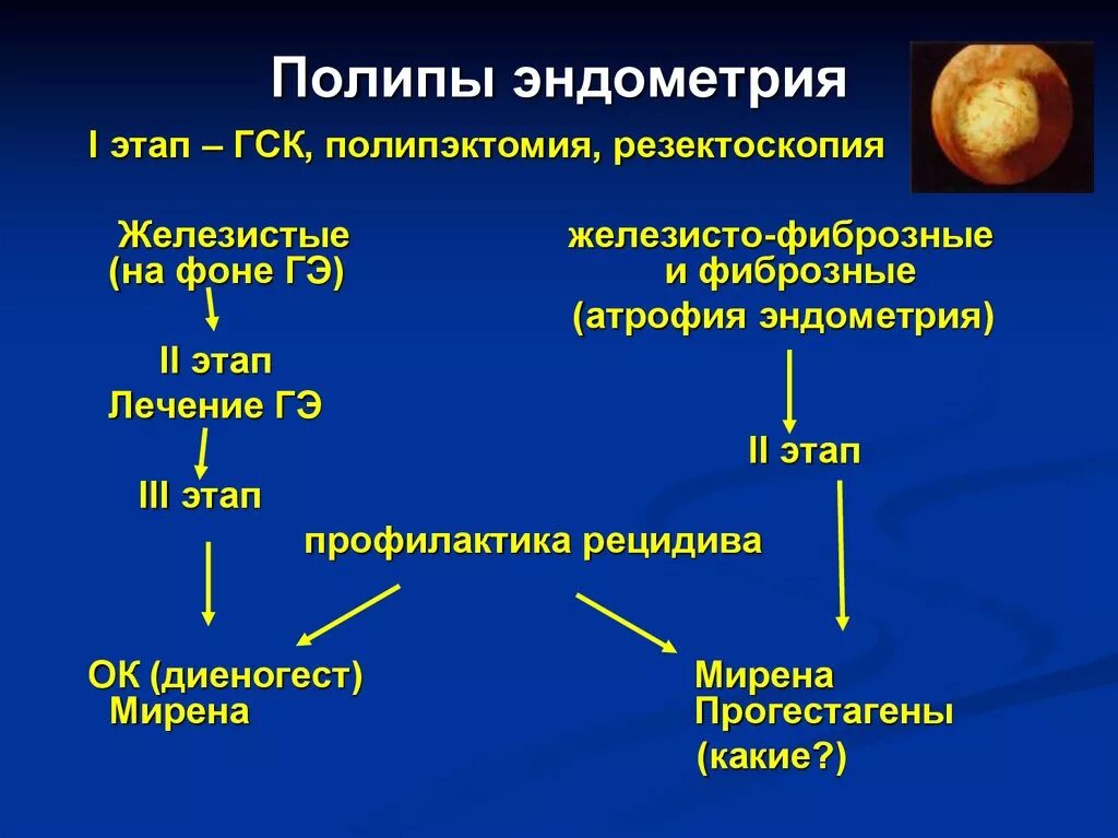 Классификация полипов матки. Полип эндометрия патогенез. Полипы эндометрия этиология. Классификация полипов эндометрия.