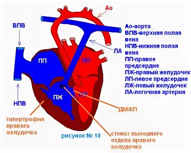 Полые вены впадают в правый желудочек. Верхняя полая Вена правое предсердие. Правый желудочек и легочная артерия. Нижняя полая Вена впадает в левое предсердие. 3 в левое предсердие впадают