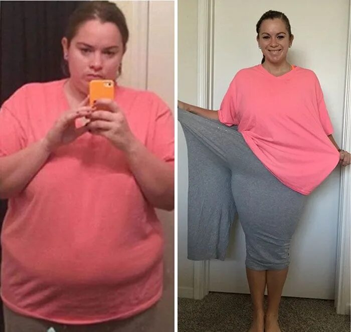 Похудение до и после. До и после похудения девушки.