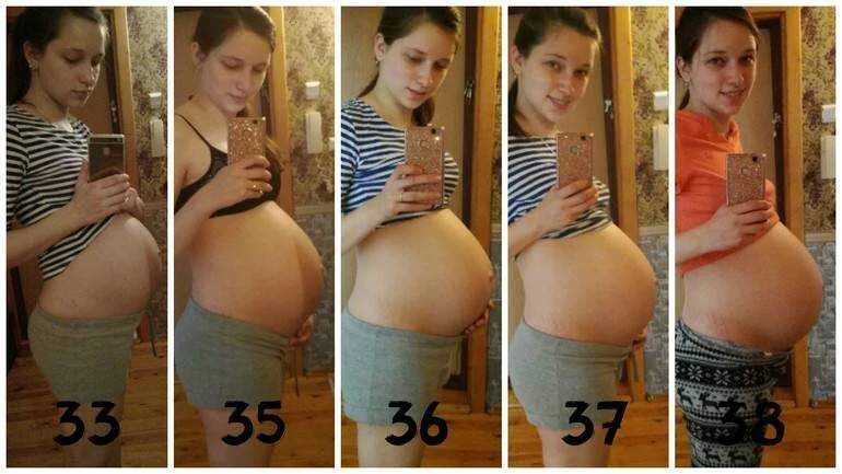 38 первый беременность. Отпусченный живот при беременности. Опущение живота перед родами. Опущенный живот перед родами. Опущение живота передбродами.