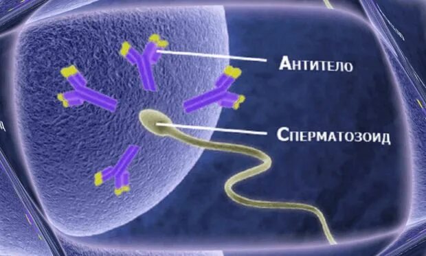 Антиспермальные антитела. Иммунологическая форма мужского бесплодия. Антиспермальные антитела у женщин. Иммунологические факторы бесплодия. Иммунное бесплодие