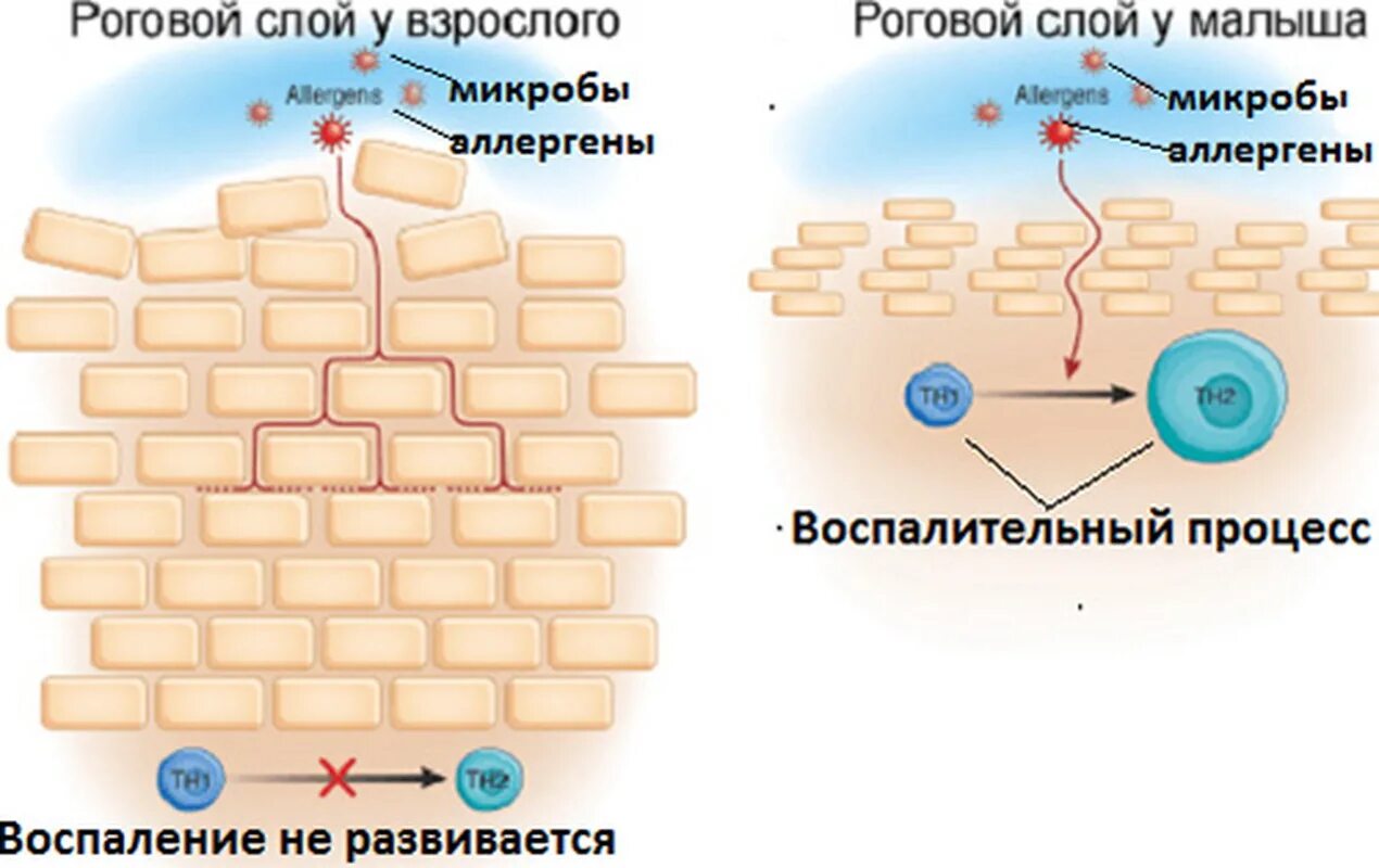 строение кожи лица слои. кожа структура и строение. эпидермис у детей. особенности эпидермиса у детей. степени отморожения со слоями кожи.