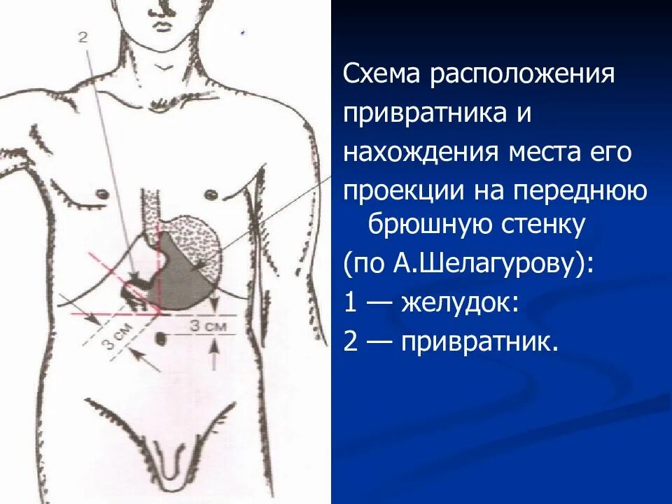 Пальпация живота. Проекция желудка на переднюю брюшную стенку. Проекция привратника на переднюю брюшную стенку. Желудок расположение проекция на переднюю брюшную стенку. Расположение привратника желудка.