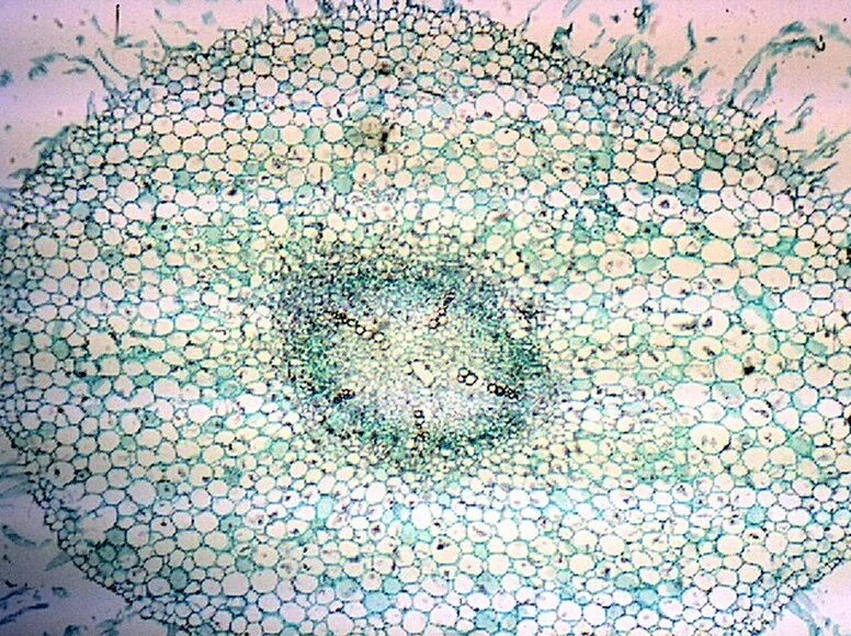 Микропрепарат травянистого стебля. Ткани растений микропрепараты. Ботаника под микроскопом. Микропрепараты анатомия растений.